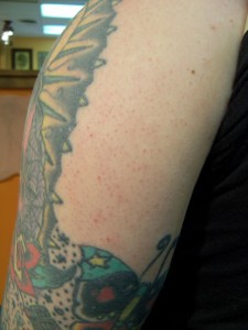 100_0380 Thom's black arm