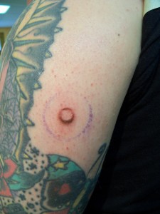 100_0388 defining nipple area