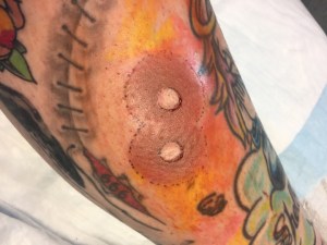 areola tattoos without nipples